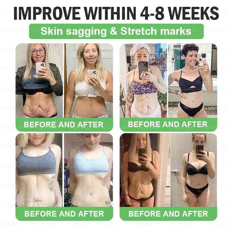๐๐๐ช๐ฏ๐ฎ๐๐๐๐ยฎ๐ Only 5 boxes left! We're offering you an additional 30% discount! Get yourself in shape and healthy. Miss out now, and you won't have another chance until next year.