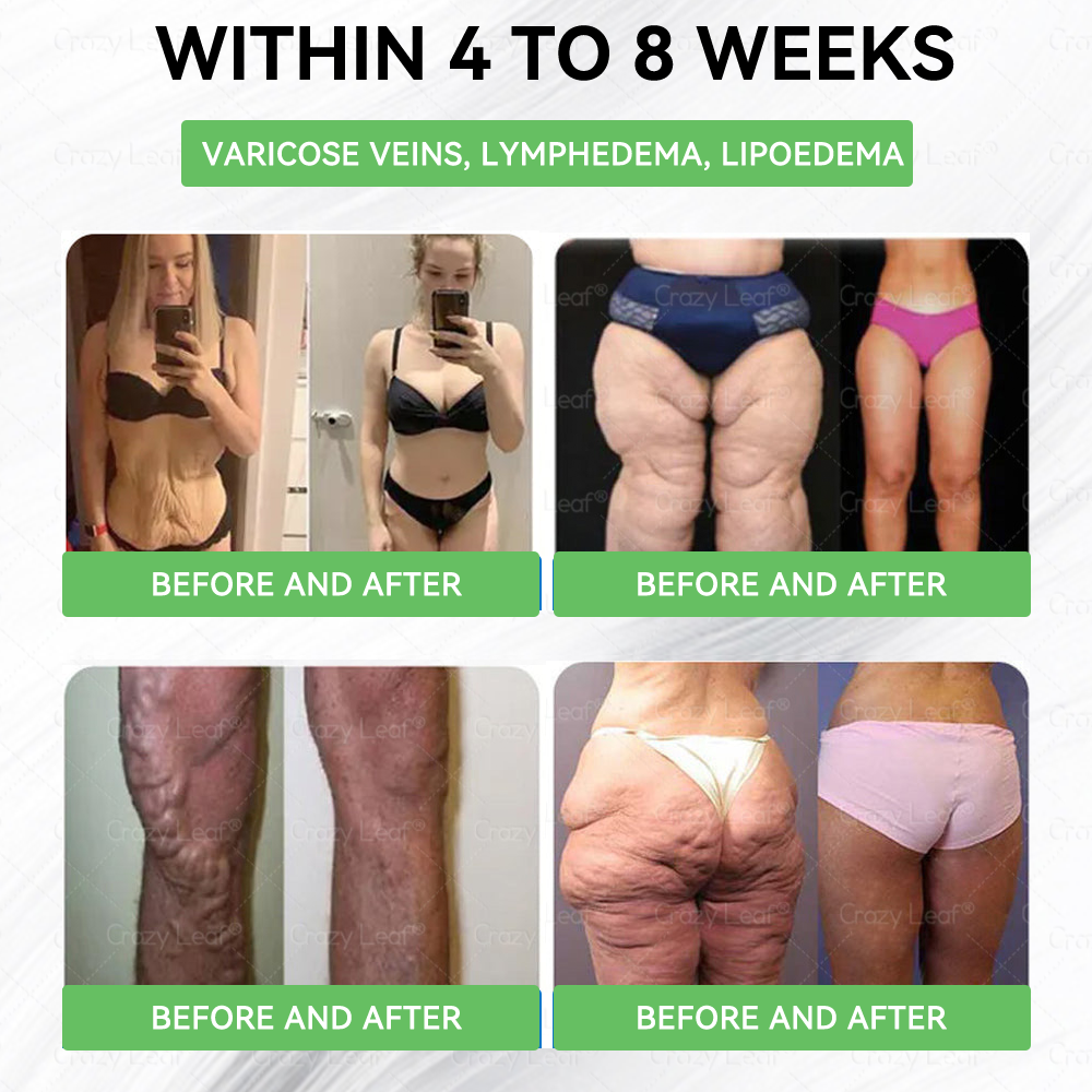 ๐๐๐ช๐ฏ๐ฎ๐๐๐๐ยฎ๐ Only 5 boxes left! We're offering you an additional 30% discount! Get yourself in shape and healthy. Miss out now, and you won't have another chance until next year.