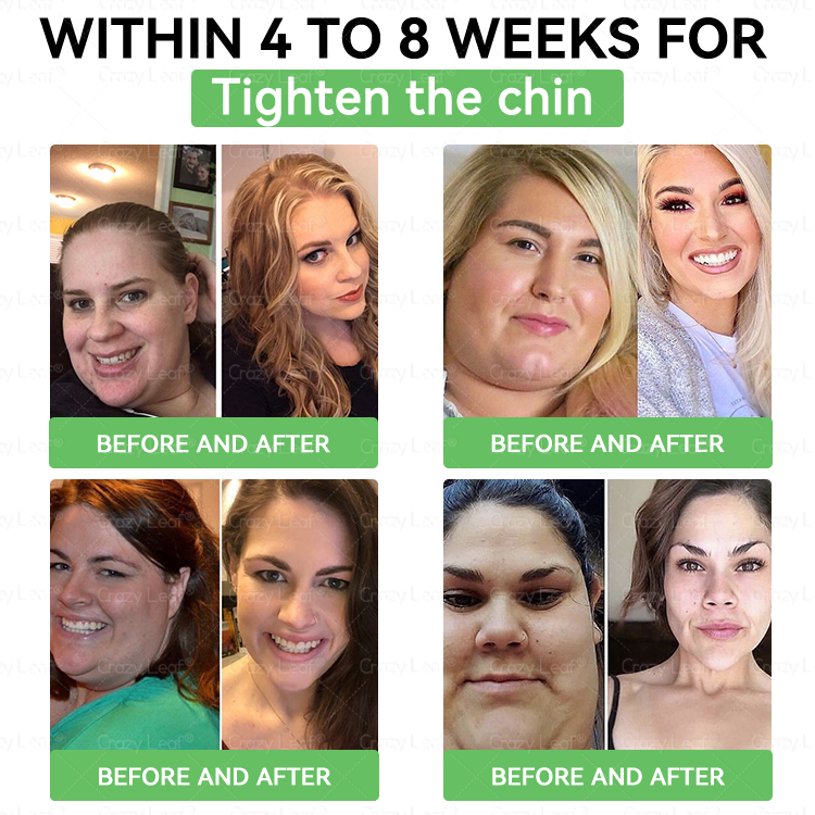 ๐๐๐ช๐ฏ๐ฎ๐๐๐๐ยฎ๐ Only 5 boxes left! We're offering you an additional 30% discount! Get yourself in shape and healthy. Miss out now, and you won't have another chance until next year.