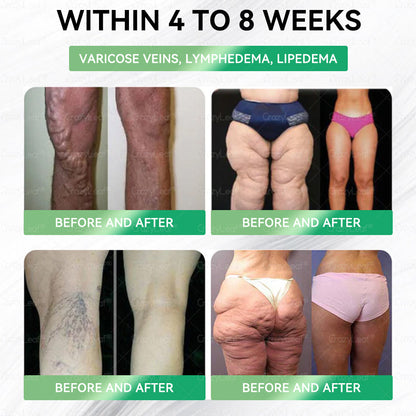 𝐂𝒓𝓪𝙯𝙮𝐋𝑒𝑎𝐟®🎁 Only 5 boxes left! We're offering you an additional 30% discount! Get yourself in shape and healthy. Miss out now, and you won't have another chance until next year.